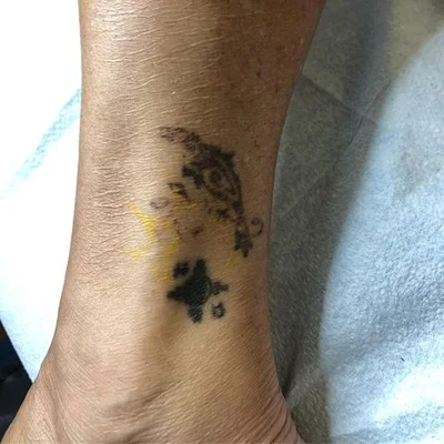 Mike Arneson tattoo 019