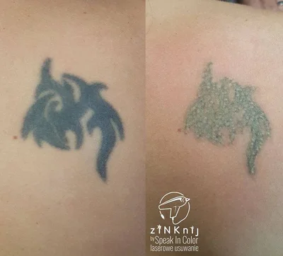 zINKnij tattoo 017